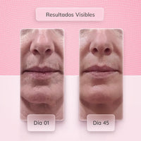 MASAJEADOR FACIAL SKINDION+ Minimasajeador de regalo🎁