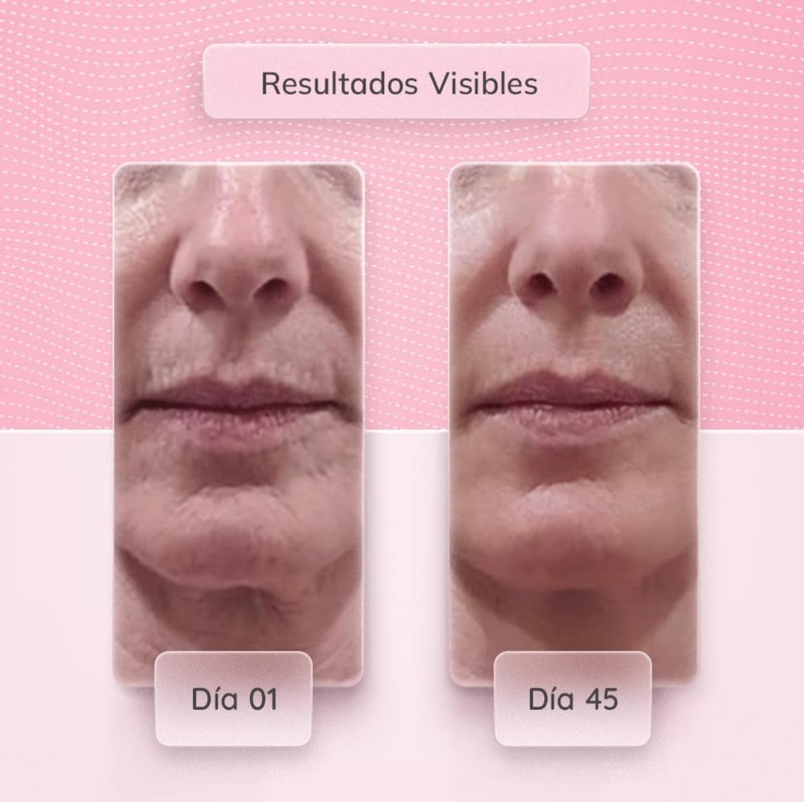 MASAJEADOR FACIAL SKINDION+ Minimasajeador de regalo🎁