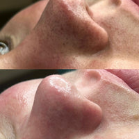 Limpiador UltraSkin™ – Tecnología ultrasónica para tu piel
