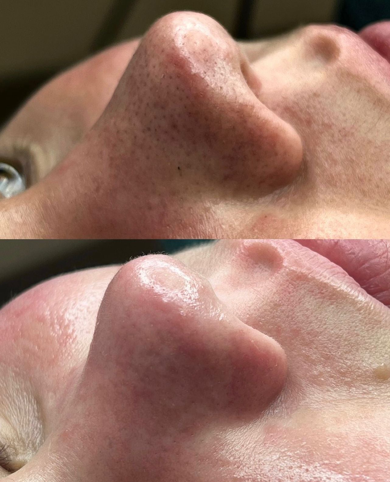 Limpiador UltraSkin™ – Tecnología ultrasónica para tu piel