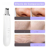 Limpiador UltraSkin™ – Tecnología ultrasónica para tu piel