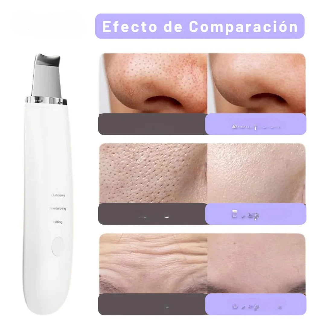 Limpiador UltraSkin™ – Tecnología ultrasónica para tu piel